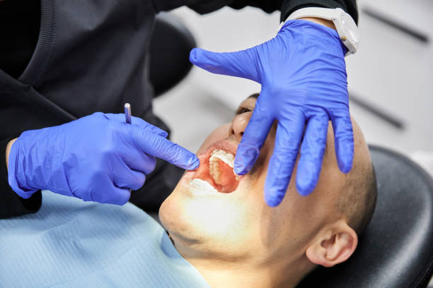 Best Broken or Chipped Tooth Repair in St Louis Park, MN